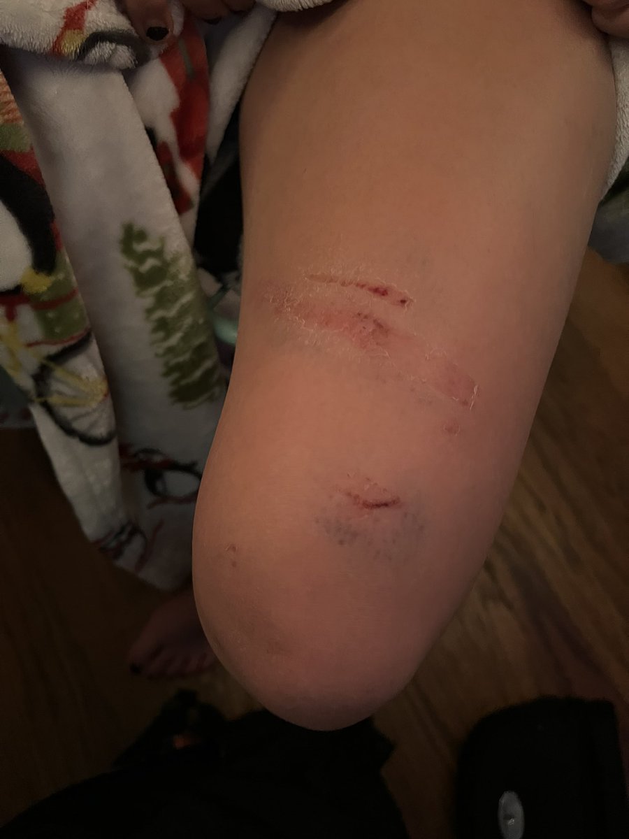 At least she was out at home 😃🥎#catcher <a href="/IndyMustangs06/">Devin Sanders</a> <a href="/sb_nchs_In/">NCHSSbPanthers</a>