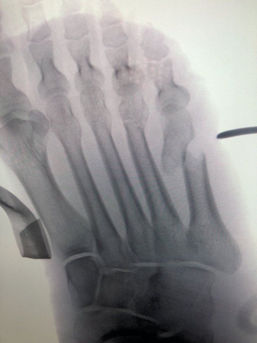 Yelena Bogdan, MD, FACS, FAAOS tweet media