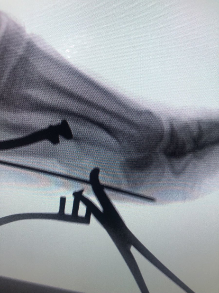 Yelena Bogdan, MD, FACS, FAAOS tweet media