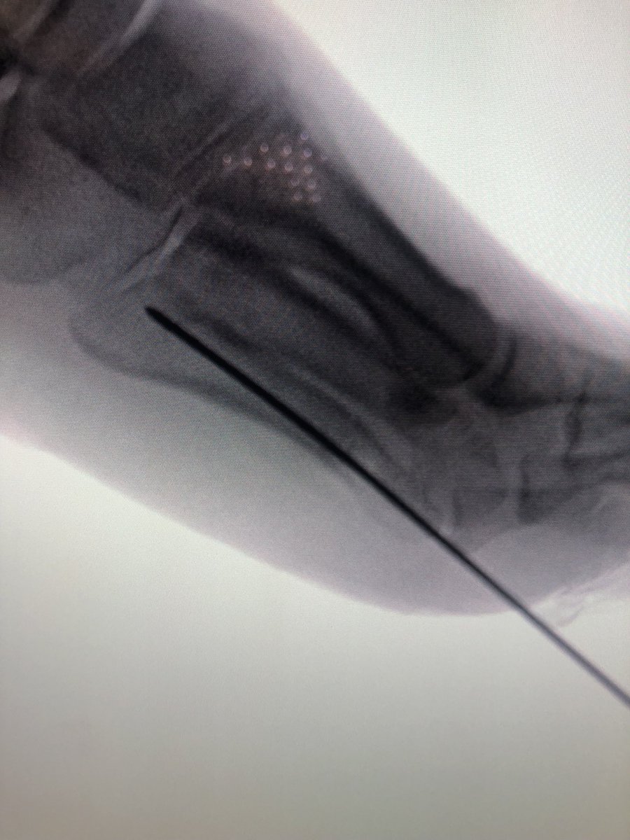 Yelena Bogdan, MD, FACS, FAAOS tweet media