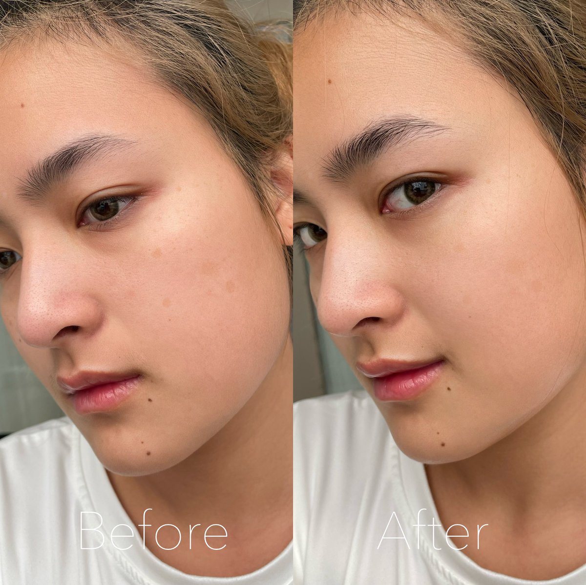 pimrypraew's tweet photo. เมื่อก่อนผิวหน้าเป็นรูขุมขนกว้าง ไม่เคยใช้เลย แต่พอมาลองใช้เซรั่มโรจูคิสสีน้ำตาล ตัวดังตัวนี้รอดตายนะ รูขุมขนกระชับขึ้นเยอะเลย ผิวเนียน ใช้ประมาณ 3 หยดต่อครั้ง ตอนนี้เลิ้ปมาก ถูกใจมาก หาซื้อง่ายไปเซเว่นโลด ซองละ 39 บาท #ของดีบอกต่อ #ใช้จริงรีวิวจริง https://t.co/339Oym2rSa
