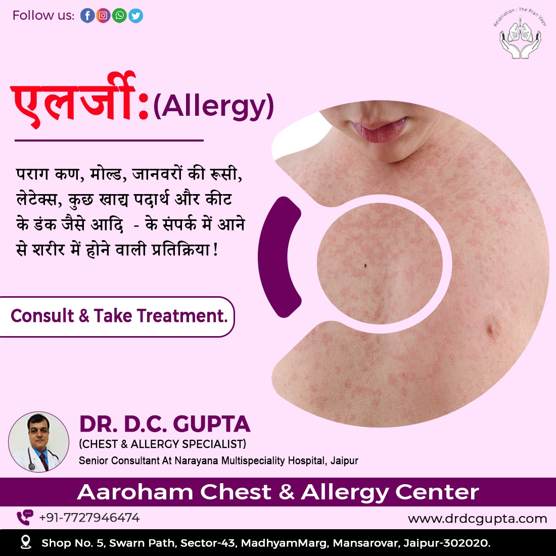 dcguptaclinic's tweet photo. एलर्जी (Allergy)
पराग कण, मोल्ड, जानवरों की रूसी, लेटेक्स, कुछ खाद्य पदार्थ और कीट के डंक जैसे आदि  - के संपर्क में आने से शरीर में होने वाली प्रतिक्रिया
For more info consult us.
#drdcgupta #chestspecialist  #consult #taketreatment #bestallergydoctor #chestspecialistdoctor https://t.co/Ay6GC4ii5z