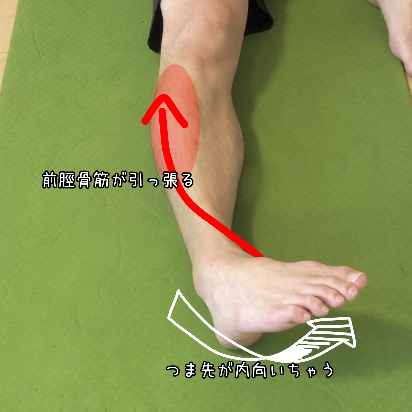 みつやま コンディショニングトレーナー 床で脚を伸ばすとつま先が内に倒れてしまうのはあんまりよろしくなくてですね 深くしゃがめなくなったり 膝が痛くなったり 足首が太くなったります だいたい前脛骨筋とアキレス腱の辺りが塊になってることが多い