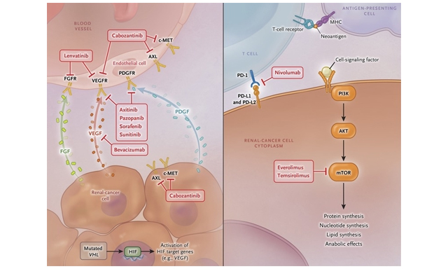 OAE_JCMT's tweet photo. #MDC #Biomarker #IndividualizedTherapy #Immunotherapy #VEGF #Prognosis
🥳Interesting article sharing #mRCC
Title: Individualized therapy for metastatic renal cell carcinoma
👤Authors: Bambang T. Atmaja, Izabelle Wood, Suyanto Suyanto, et al.
Link➡️https://t.co/h0c2mXTfLA https://t.co/k9TdCSAICt