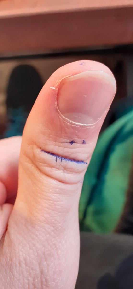 When your sheep are acting sus.