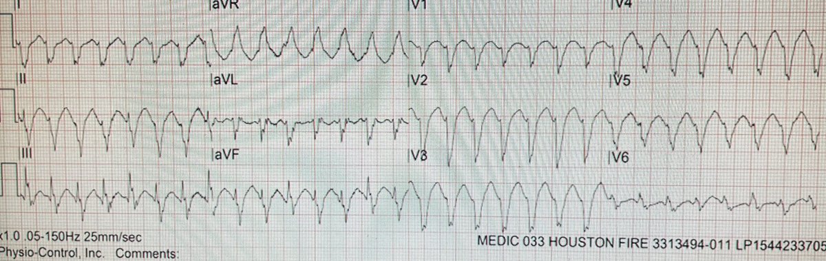 TakenakaKay's tweet photo. Reviewing EKGs with our experts is the best @bcooper876 @EcgStampede #McGovernEMConference https://t.co/Qzkg5gmASx
