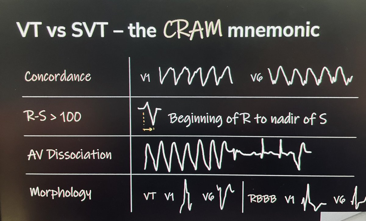 TakenakaKay's tweet photo. Reviewing EKGs with our experts is the best @bcooper876 @EcgStampede #McGovernEMConference https://t.co/Qzkg5gmASx