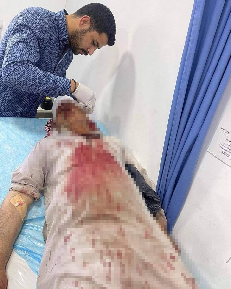 pbi_es's tweet photo. Raja Barakat de 62 años fue atacado y agredido por colonos ilegales mientras trabajaba en su tierra cerca del asentamiento de Ma,ale Amos, al sureste de Belén.
#Palestina
#apartheidisrael
#PalestinaLibre https://t.co/UGoolu3Krl