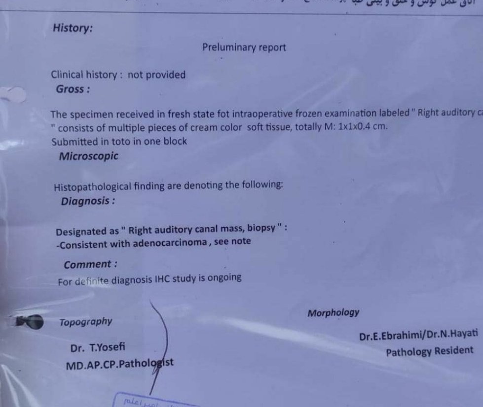 Samir82697221's tweet photo. https://t.co/fKrqyW5wqK
Hi dears
Help me pay for my cancer

Bitcoin: bc1qhxmgksk5lagdzytt6g69n3u2hlqqh4hqca9m4v
Tron:
TVW3KHTyZ2UgXhkwhuCf6yyidxGP2XENBJ
Dogcoin:
D7Waahyobvd1dwcE61wMvtZYEVHGHfujTe https://t.co/7fLJo81wtK