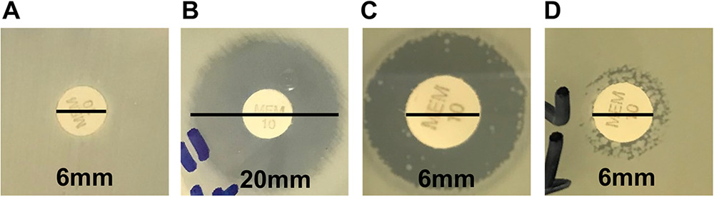 JClinMicro's tweet photo. Development and Validation of a Novel Anaerobic Carbapenem Inactivation Method (Ana-CIM) for the Detection of Carbapenemase Production in Bacteroides fragilis

https://t.co/hoM1KOjxlX @ASMicrobiology @schuetz_audrey @BurnhamBugDoc https://t.co/8TThUTq01Q