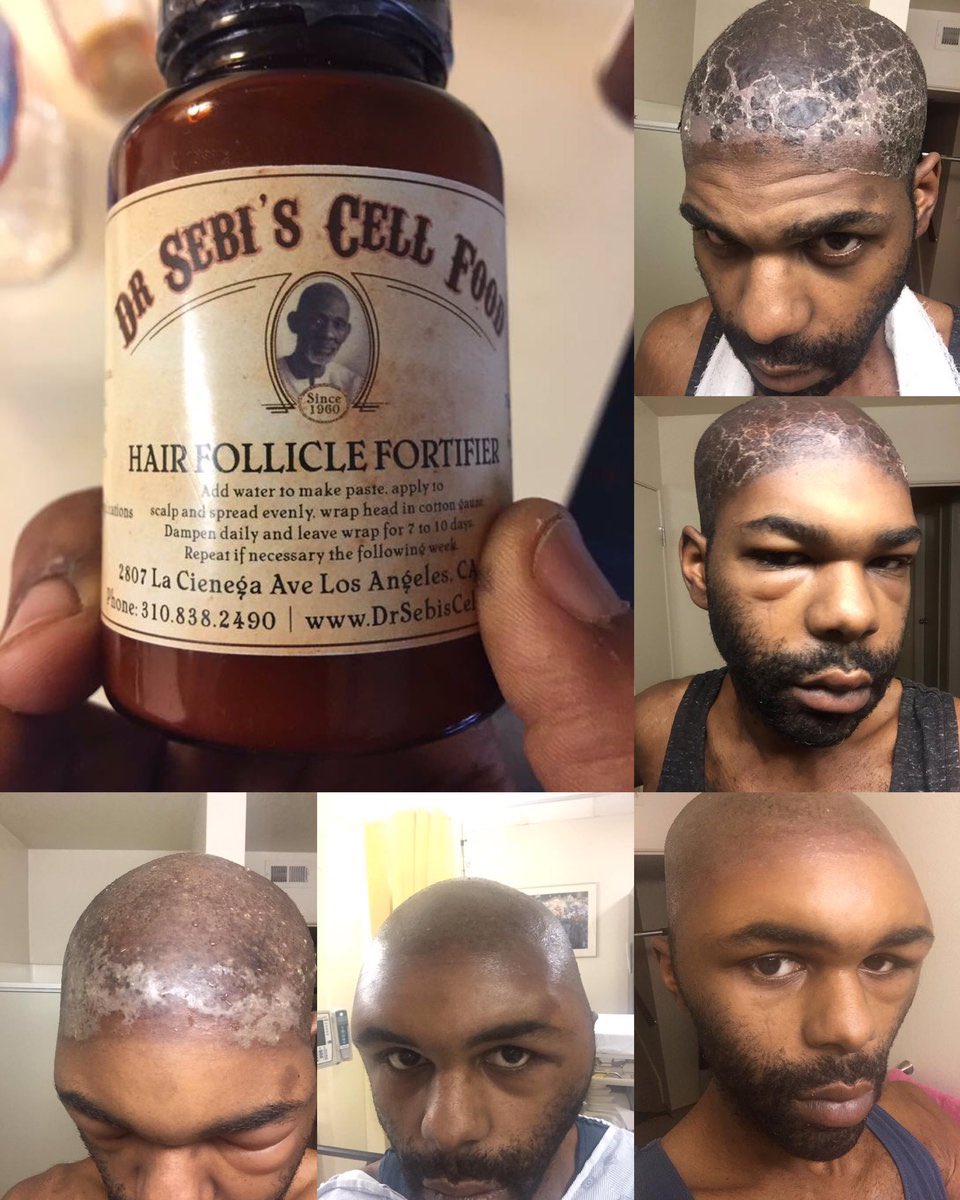 I have nothing else to promote except Dr. Sebi’s Hair Follicle Fortifier. 