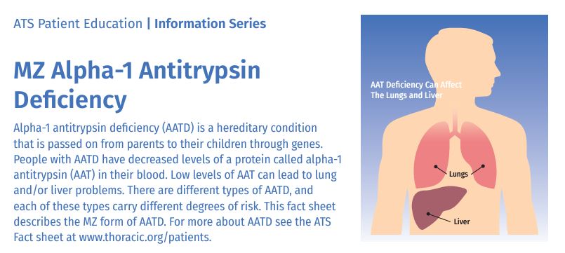RCSI_RespLab's tweet photo. People who have MZ #alpha1 antitrypsin deficiency (AATD) are at significantly increased risk of developing #COPD if they smoke. Some reading material for newly diagnosed MZ's in @ATSBlueEditor, co-authored by one of our AATD patients: https://t.co/VpKKyhGnXN https://t.co/zhN0SMbHAQ