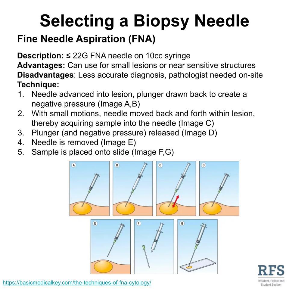 Feasibility Thermal Call Core Needle Aspiration Complement Supervise feasibility-thermal-call-core-needle-aspiration-complement-supervise