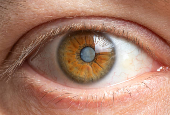 clinicalasik's tweet photo. ¿Conoces los 3 tipos de #defectosVisuales que hay? https://t.co/vD4q1Pwer1 https://t.co/gXn1DxNqib