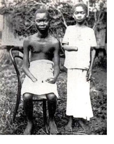 Never forget the barbarities of Belgium in the Democratic Republic of the Congo.