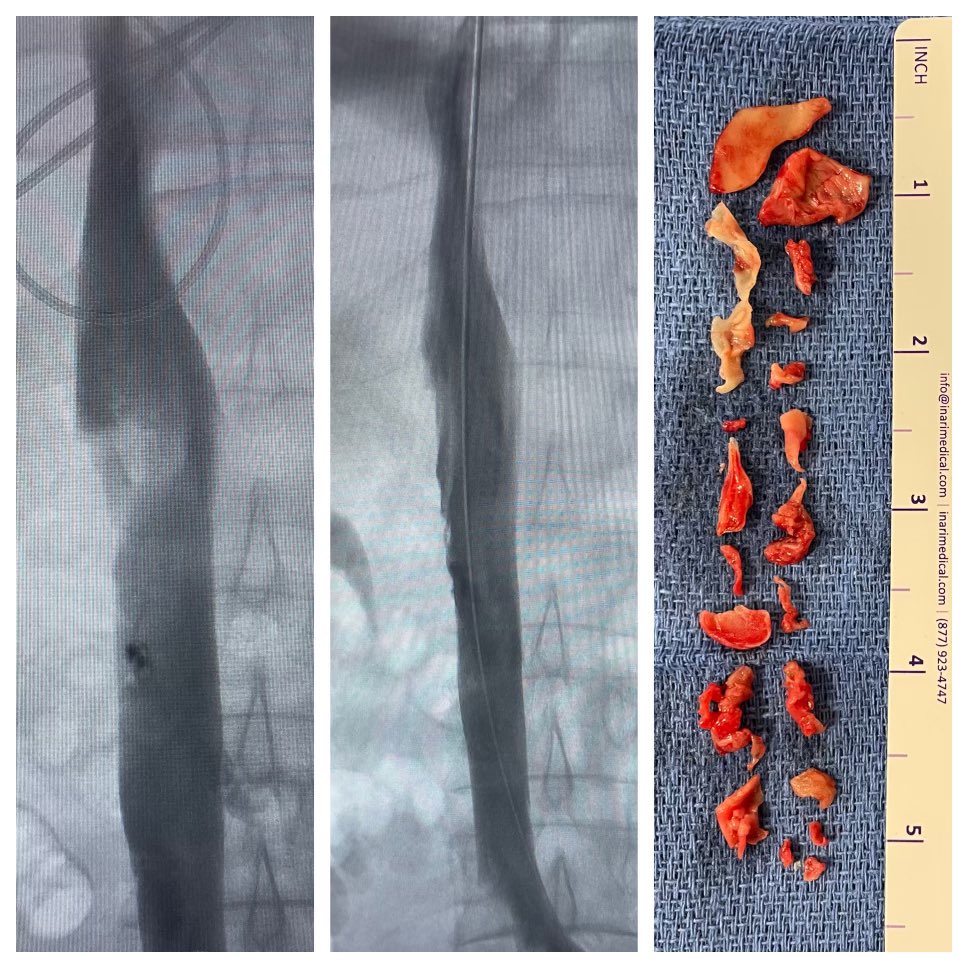 Raja Ramaswamy, MD tweet media