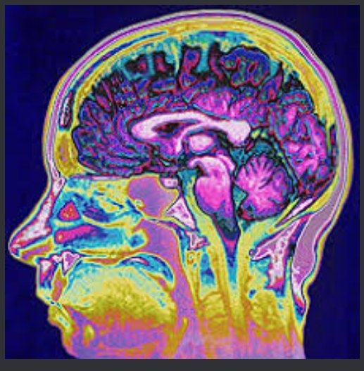 Aiaxthunder's tweet photo. Neuroscienze spiegano il cervello dei leader associandolo a quello degli atleti d'elite che devono vincere. In Serie A non ho mai visto funzionare la narrazione buoni Vs cattivi. 
 @ferrarailgrasso @alesallusti @Serv_Pubblico @corradoformigli @corradoformigli @ArenaGiletti https://t.co/P01T9N7YtV