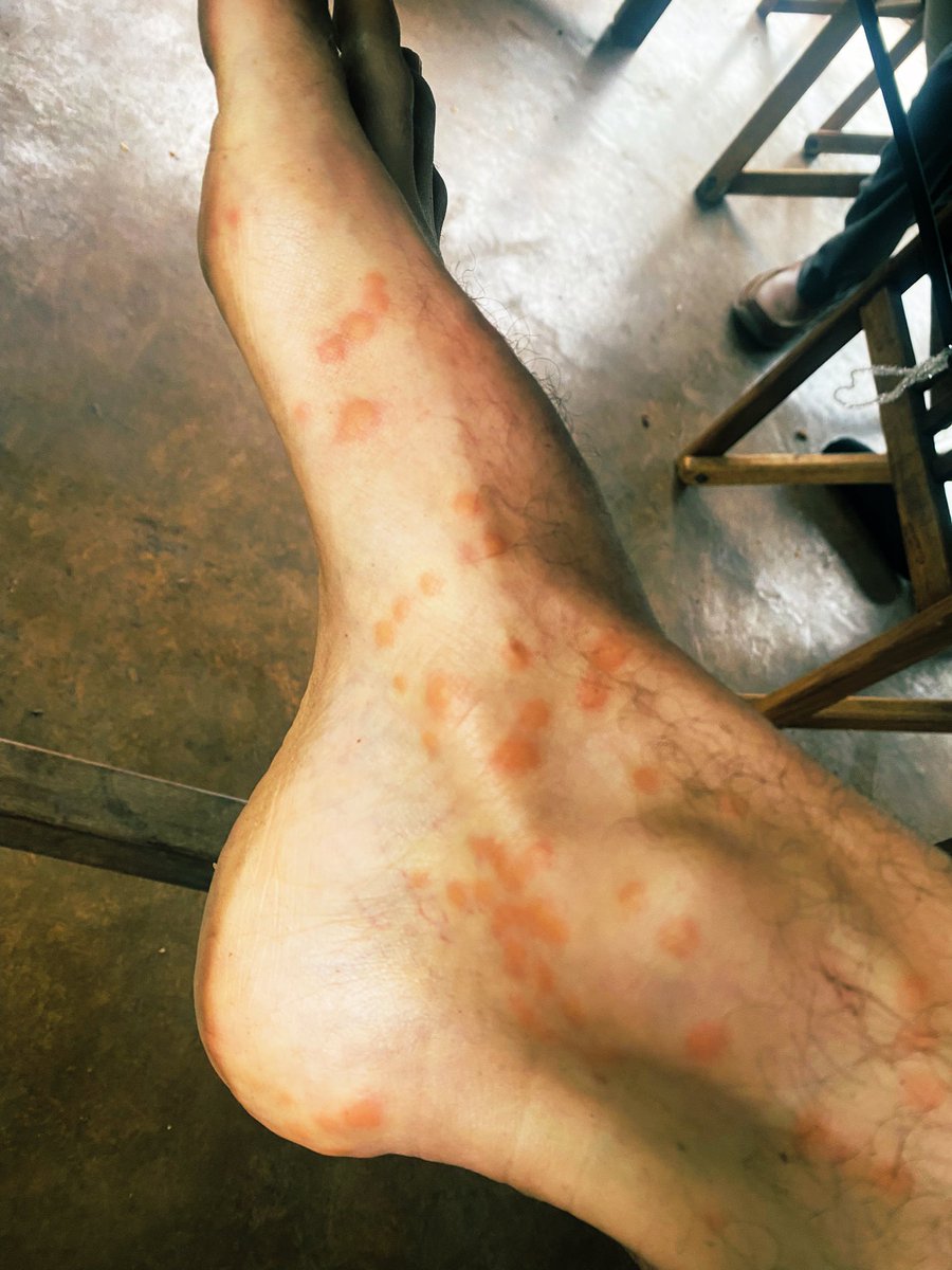 HoekMR's tweet photo. Hard to leave work behind…. Which PHD student wants a blood sample for virus identification? Didn’t manage to squat a single one for the mosquito ALERT app…. @fredbartu @OneHealthPact @MarionKoopmans https://t.co/UlMhcWMJBH