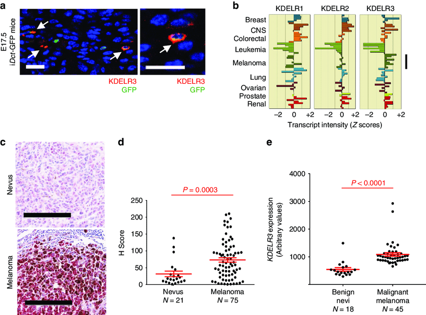 L'INCIT est heureux d'accueillir le Dr. Heinz Arnheiter (Chercheur Emerite au NIH), lors de son séminaire qui aura lieu le Lundi 30 mai à 13.30, à l'IRS UN (Nantes). Il nous parlera de : «SNS, PAMPS, DAMPS, RAMPS: A short run through 70 years of immunological theory ».