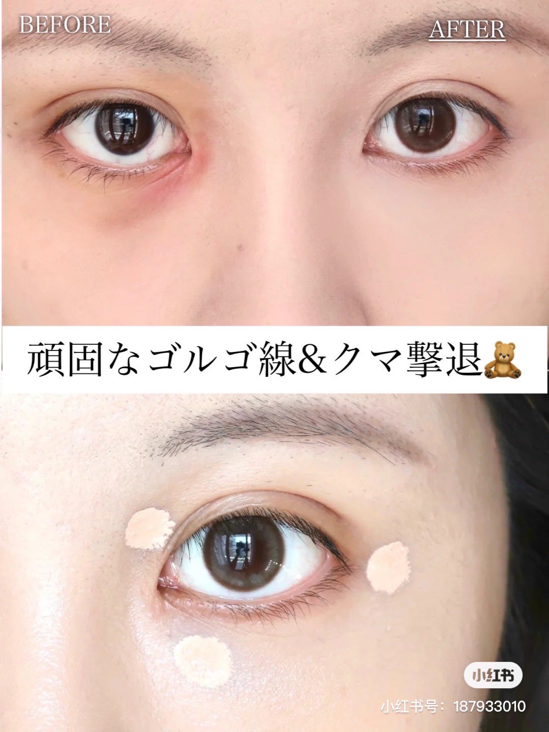 紅美女 頑固なゴルゴ線 クマ 色素沈着までまっさらに 中国でバズっている新テクニック コンシーラー3点置き コンシーラーをクマ 目頭 目尻の3点に置き 指でぼかしていく コンシーラーをゴルゴ線にのせぼかし 上から粉をのせる 紅美女 頑固なゴルゴ線 クマ 色素沈着までまっさらに 中国でバズっている新テクニック コンシーラー3点置き コンシーラーをクマ 目頭 目尻の3点に置き 指でぼかしていく コンシーラーをゴルゴ線にのせぼかし 上から粉をのせる