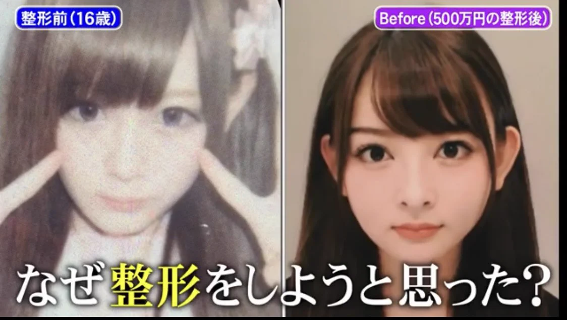 心が痛くなる…元彼にブスと言われて整形した人…