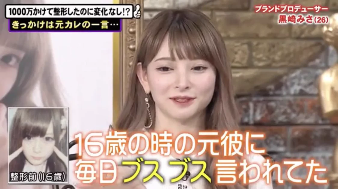 心が痛くなる…元彼にブスと言われて整形した人…