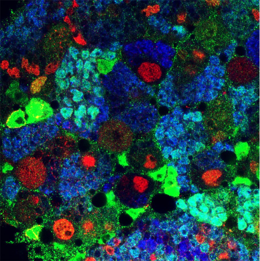 CSICval's tweet photo. Un grupo de investigación del @NeuroAlc ha descubierto que unas moléculas llamadas Netrinas son capaces de regular el exceso de proliferación de las células madre y progenitoras neurales, una función desconocida hasta ahora. 

https://t.co/hh0b8JqIGv

#neurociencia | #cerebro https://t.co/wP0zZCKyNL