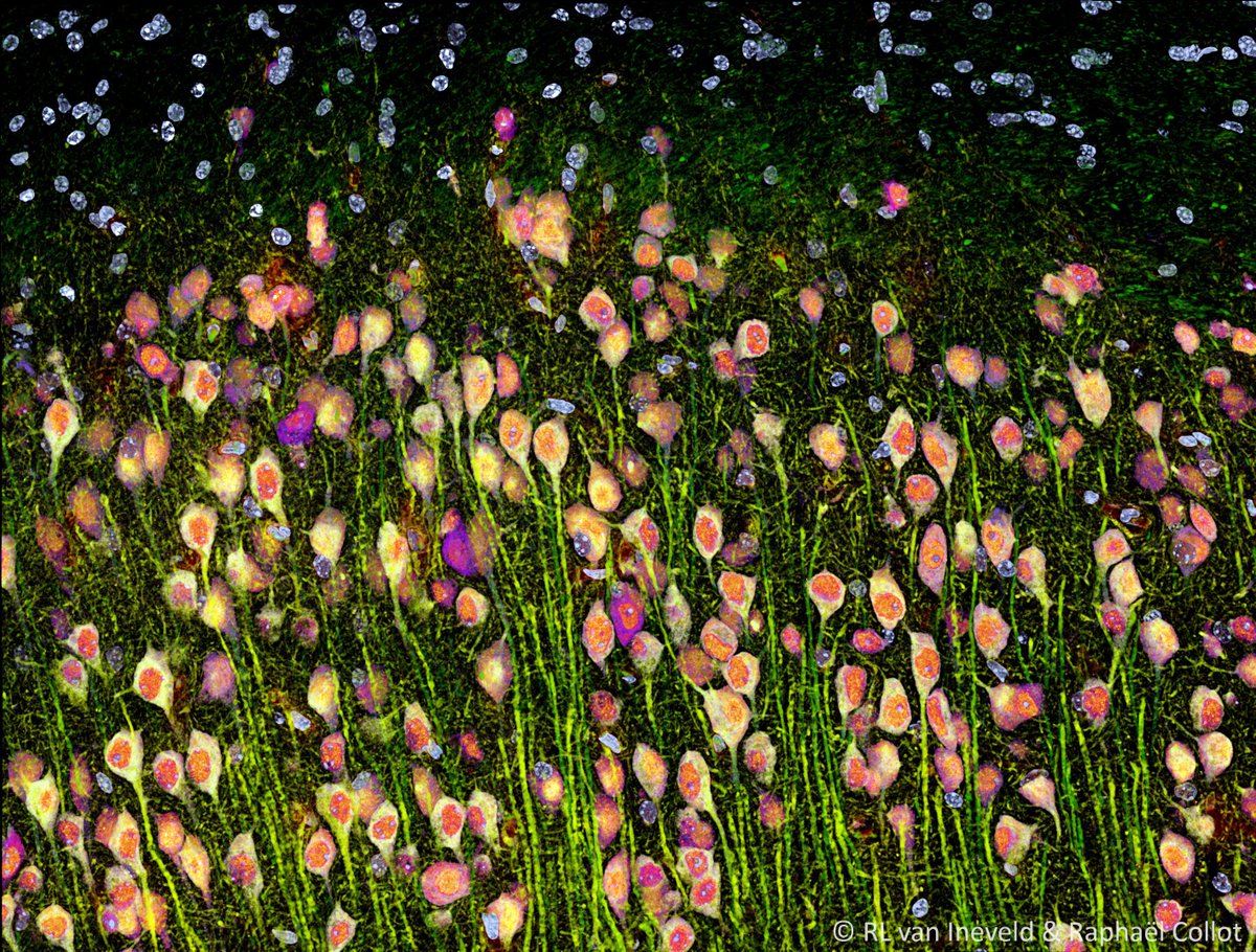 Dream3D Lab (@dream3dlab) on Twitter photo Neurons looking like a spring flower painting! Very excited about this data <a href="/rlvanine/">Ravian L. van Ineveld</a> and <a href="/ra_collot/">ra.collot</a> obtained during our recent demo of the <a href="/zeiss_micro/">ZEISS Microscopy</a> LSM980 with LSMPlus. #FluorescenceFriday #FluorescentFriday 🌷🌻🌼 Neurons looking like a spring flower painting! Very excited about this data <a href="/rlvanine/">Ravian L. van Ineveld</a> and <a href="/ra_collot/">ra.collot</a> obtained during our recent demo of the <a href="/zeiss_micro/">ZEISS Microscopy</a> LSM980 with LSMPlus. #FluorescenceFriday #FluorescentFriday 🌷🌻🌼