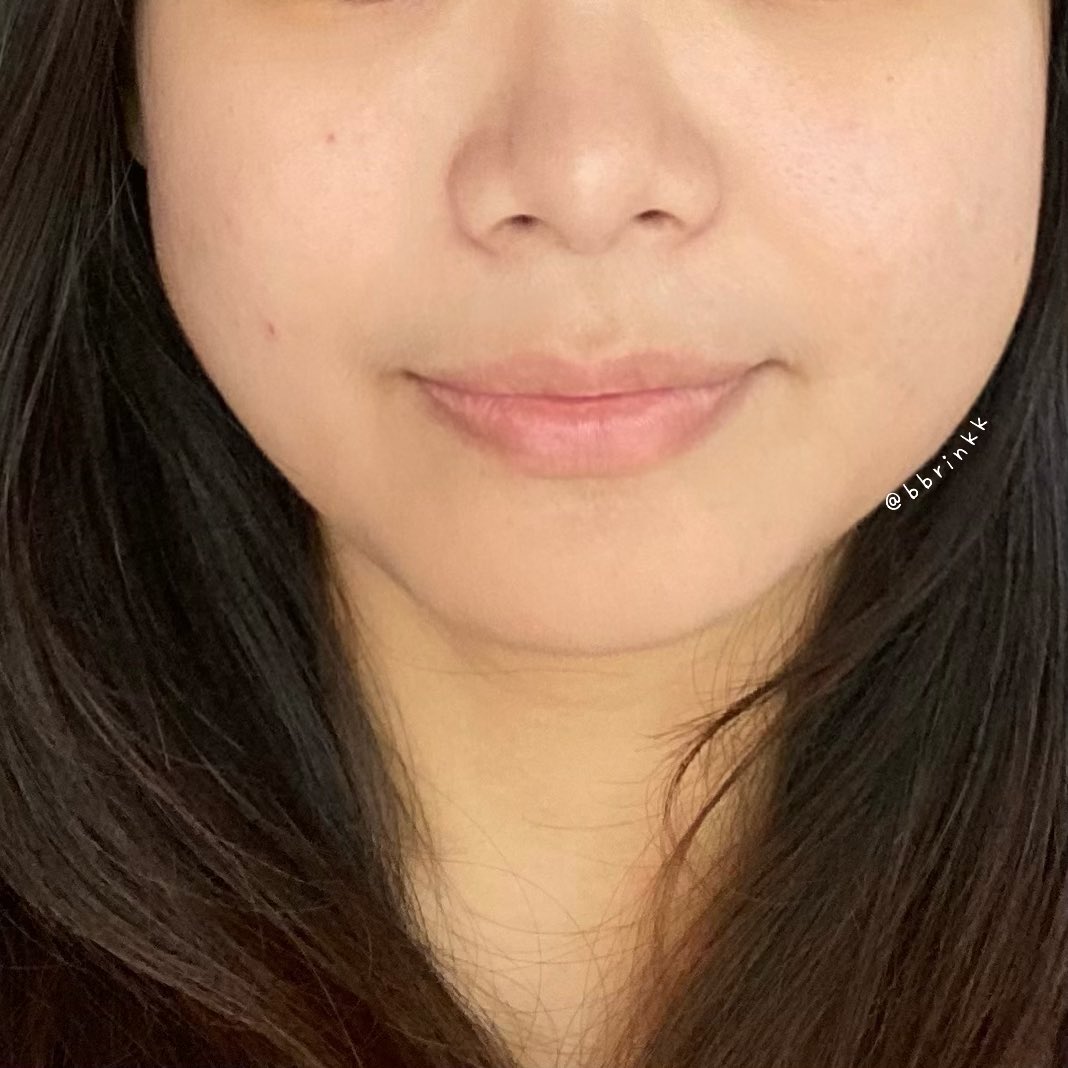 bbrinkk's tweet photo. กระแสมิสแกรนด์กำลังมา กระแส POND’S ก็มาด้วย #PondsBrightBeauty ใช้ประมาณวีคนึงรู้เรื่องเลย ผิวหน้าดีขึ้นมาก อันนี้หน้าสดให้เห็นกันไปเลย บ๊ายบายพวกรอยบนผิวแล้ว1สวยแบบ #อิงฟ้ามหานคร แล้ว 1
#เปิดโปงหน้าสด #หน้าสดสวย https://t.co/FakCVcOwZI