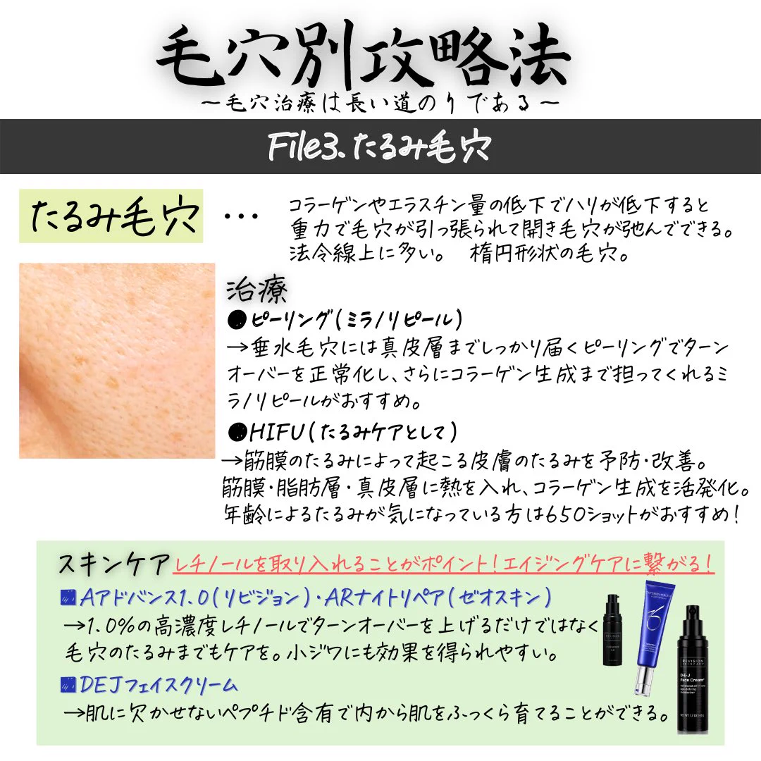 「毛穴の種類別攻略法」毛穴の種類によって攻略方法が全然違う。