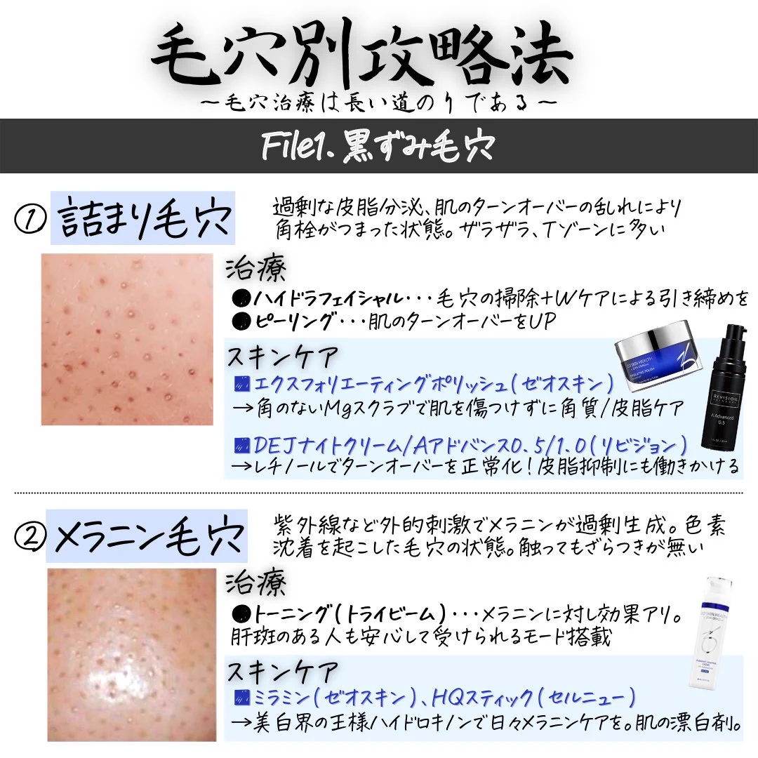 「毛穴の種類別攻略法」毛穴の種類によって攻略方法が全然違う。