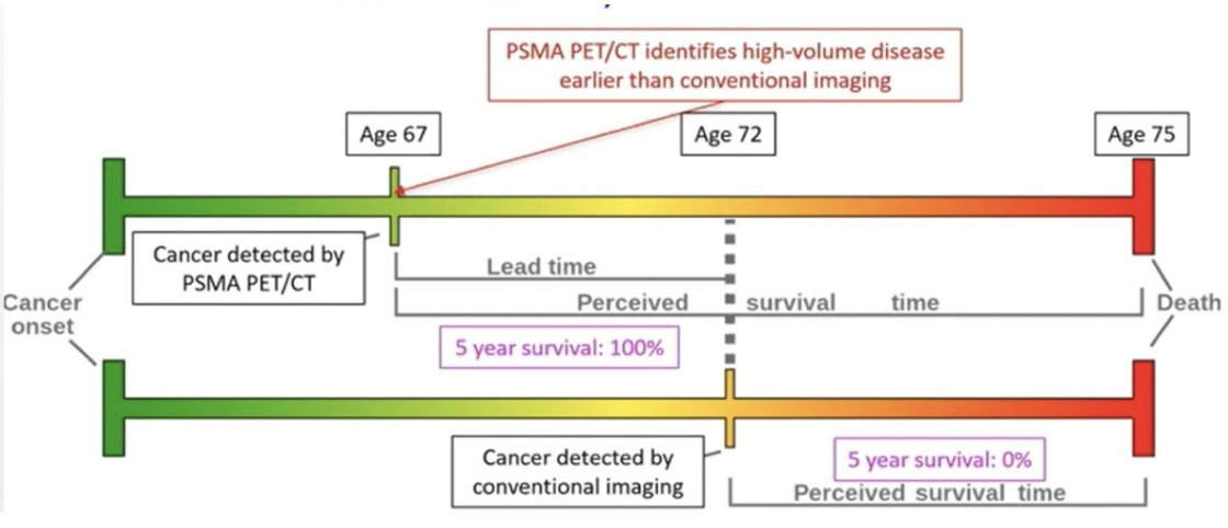UroToday.com (@urotoday) on Twitter photo When low-volume on conventional imaging goes into high-volume on next-generation imaging in #mHSPC - Treat like high-volume. Presentation by <a href="/Prof_IanD/">Ian Davis (Bluesky @profiand)</a> <a href="/MonashUni/">Monash University</a>. #APCCC22 written coverage by <a href="/zklaassen_md/">Zach Klaassen</a> <a href="/GACancerCenter/">Georgia Cancer Center</a> on UroToday > bit.ly/3vJMo0A <a href="/APCCC_Lugano/">Advanced Prostate Cancer Consensus Conference</a> When low-volume on conventional imaging goes into high-volume on next-generation imaging in #mHSPC - Treat like high-volume. Presentation by <a href="/Prof_IanD/">Ian Davis (Bluesky @profiand)</a> <a href="/MonashUni/">Monash University</a>. #APCCC22 written coverage by <a href="/zklaassen_md/">Zach Klaassen</a> <a href="/GACancerCenter/">Georgia Cancer Center</a> on UroToday > bit.ly/3vJMo0A <a href="/APCCC_Lugano/">Advanced Prostate Cancer Consensus Conference</a>