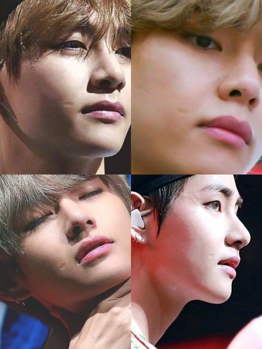 shinetete's tweet photo. TAEHYUNG'S SCAR IS SO BEAUTIFUL https://t.co/YOtBhPTBeP