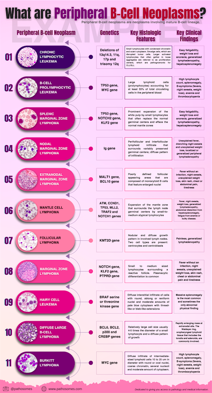 pathosomes's tweet photo. What are peripheral B-cell neoplasms? 

#cancer #meded #research #science #health #healthcare #pathosomes #twitterpath #MedStudentTwitter #medtwitter #PathMatch2023 #FOAMed #hemepath #Match2023 #path2path https://t.co/KDPgkB2wqd