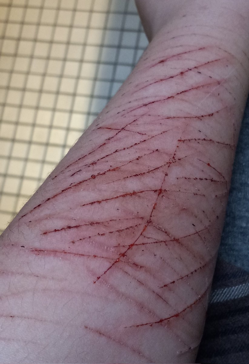 bl00dlusterr's tweet photo. They look so gross but so cool at the same time 

-

shtwt ouchietwt https://t.co/dbTK77xYue