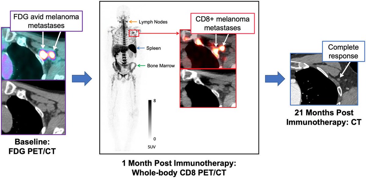 Excited to see this published! Especially honored that it made the cover, and was selected as the Featured Article of the Month! jnm.snmjournals.org/content/63/5/7…