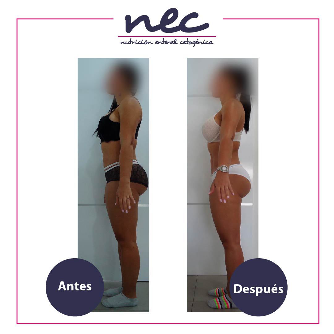 MetodoNec's tweet photo. Este tratamiento está diseñado para todas aquellas personas que quieran disminuir su porcentaje de grasa sin perder masa muscular💪.

Si deseas más información, ingresa a https://t.co/LRC2M1Apmm
-
#métodonec #bajardepeso #bajardepesorapido  #estilodevidasaludable https://t.co/V3qnp86jK2