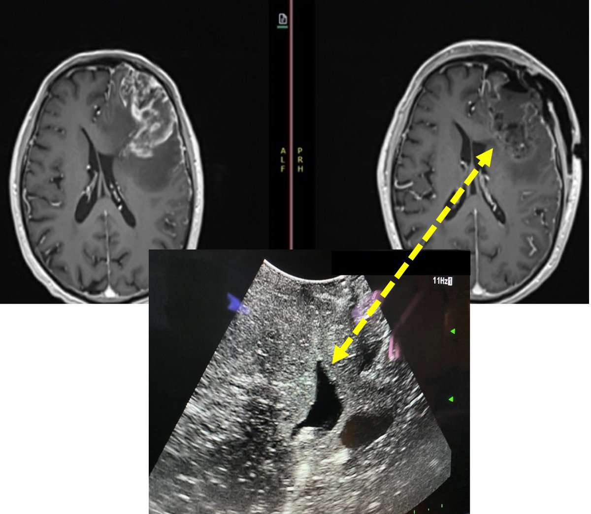 Hamid Borghei-Razavi, MD, FACS tweet media