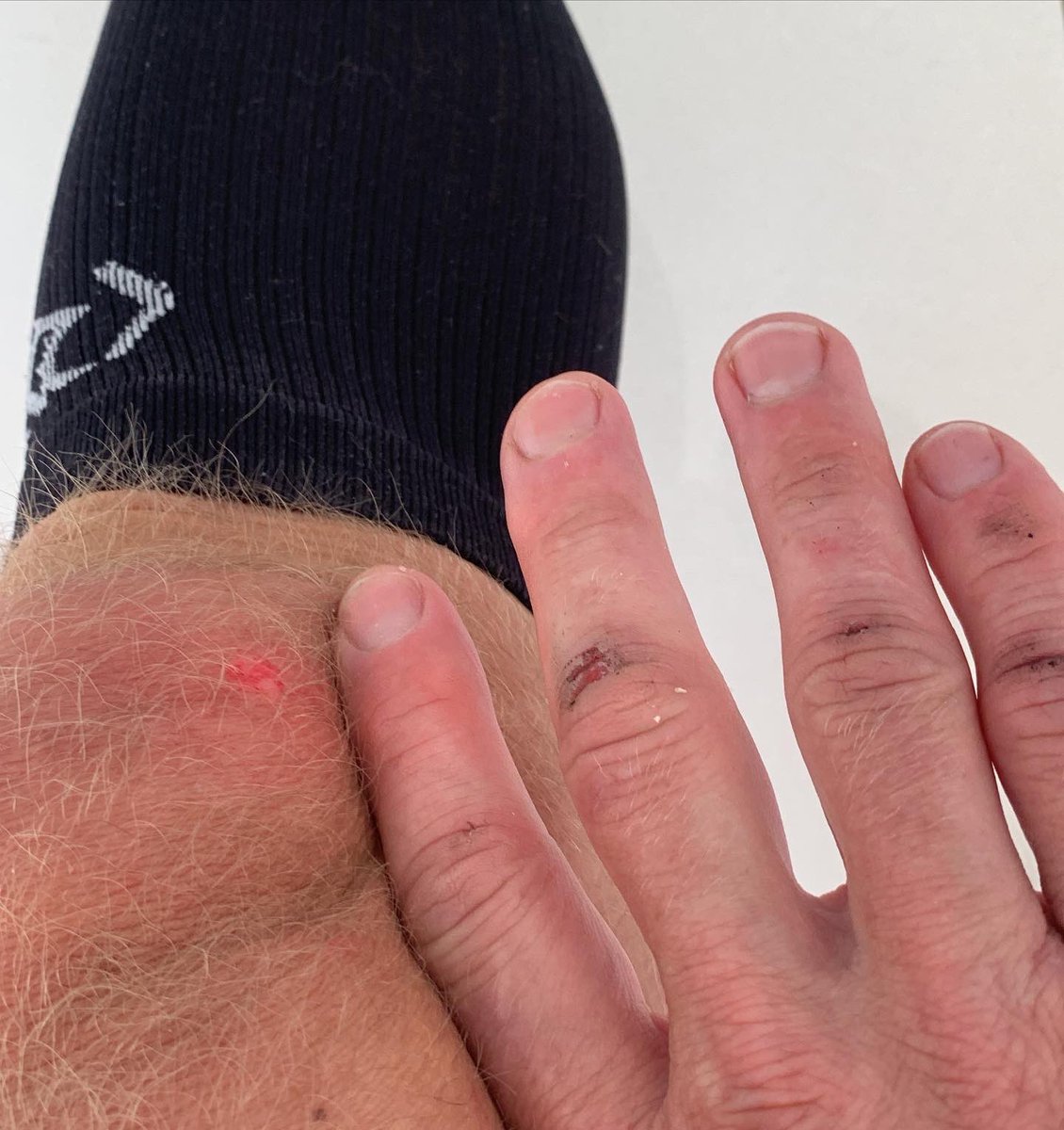 Hayden Groves👨‍🍳🚴 tweet media