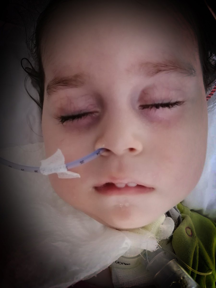 can_yasasin_'s tweet photo. Tuğçe Ebrar'ım aylardır sma ile savaşıyor..

Günler geçtikçe durumu kötüye gidiyor. Bu mücadelede bizi yalnız bırakmayın 🙏

Marmara Denizi Bartu Soral #Afara #WhatsApp Berna Sedat Peker #İstanbul #KasabaDoktoru Ersan Şen Ozark #BayramMujdesiAtama Umre Suudi Arabistan cumartesi https://t.co/ea3oA9OKC0