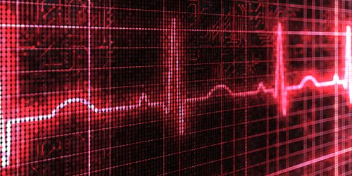 Heart_BMJ (@heart_bmj) on Twitter photo Predicting atrial fibrillation in primary care - what's the optimal way?
An enlightening discussion with <a href="/Dr_R_Nadarajah/">Ramesh Nadarajah</a>.
CHAT - soundcloud.com/bmjpodcasts/pr…
PAPER - heart.bmj.com/content/early/… (OA). Senior author <a href="/cpgale3/">Prof Chris P Gale</a>.
Please RT and pass it on! Predicting atrial fibrillation in primary care - what's the optimal way?
An enlightening discussion with <a href="/Dr_R_Nadarajah/">Ramesh Nadarajah</a>.
CHAT - soundcloud.com/bmjpodcasts/pr…
PAPER - heart.bmj.com/content/early/… (OA). Senior author <a href="/cpgale3/">Prof Chris P Gale</a>.
Please RT and pass it on!