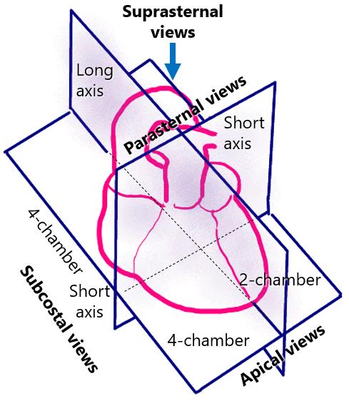 echobyweb's tweet image. Echocardiographic standard exam acquisition protocol, an imaging description and beginner's guide.
In: echobyweb.com/?page_id=250
#CardioTwitter #cvImaging #cvEcho #echofirst #cardiology #methodology