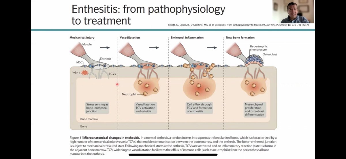 mugartegil's tweet photo. Gracias @WilsonBautistaM por tu charla sobre manejo de #entesitis en el curso de actualización de la @soc_peru https://t.co/N3ba22WLK2