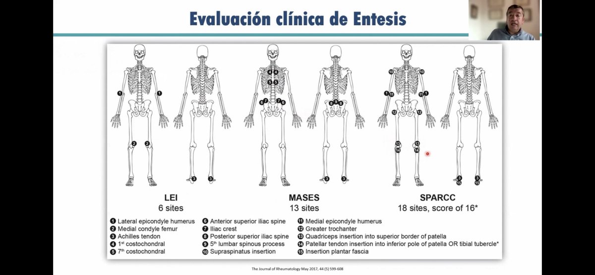 mugartegil's tweet photo. Gracias @WilsonBautistaM por tu charla sobre manejo de #entesitis en el curso de actualización de la @soc_peru https://t.co/N3ba22WLK2