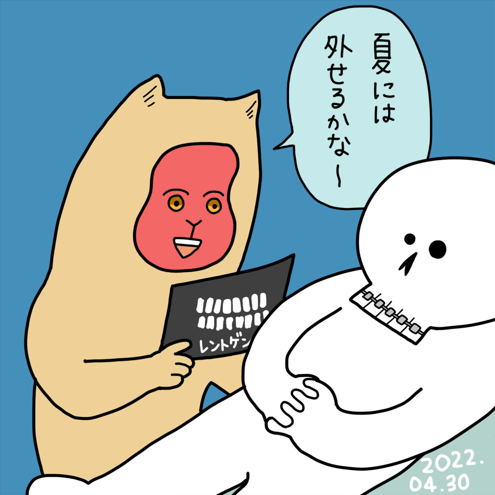 「1ヶ月ぶりの矯正歯科で調整 自分ではもういいんじゃない?って思う仕上がりだけど先生から見るともう少し下げた方がいいらしい」あさみAの漫画 「1ヶ月ぶりの矯正歯科で調整 自分ではもういいんじゃない?って思う仕上がりだけど先生から見るともう少し下げた方がいいらしい」あさみAの漫画
