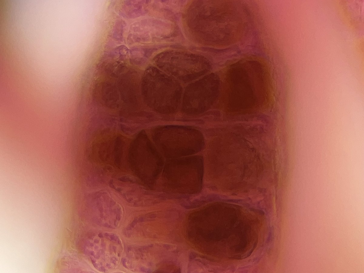 AlgaLab's tweet photo. La belleza de las algas rojas😍
👉 Estructuras reproductivas del alga “Heterosiphonia” 😲 (Tetraesporangios☮️🙂)
#algasrojas #redalgae #biodiversidadmarina #chile #biobio #phycology #ficologia https://t.co/4q8VcyUQdb