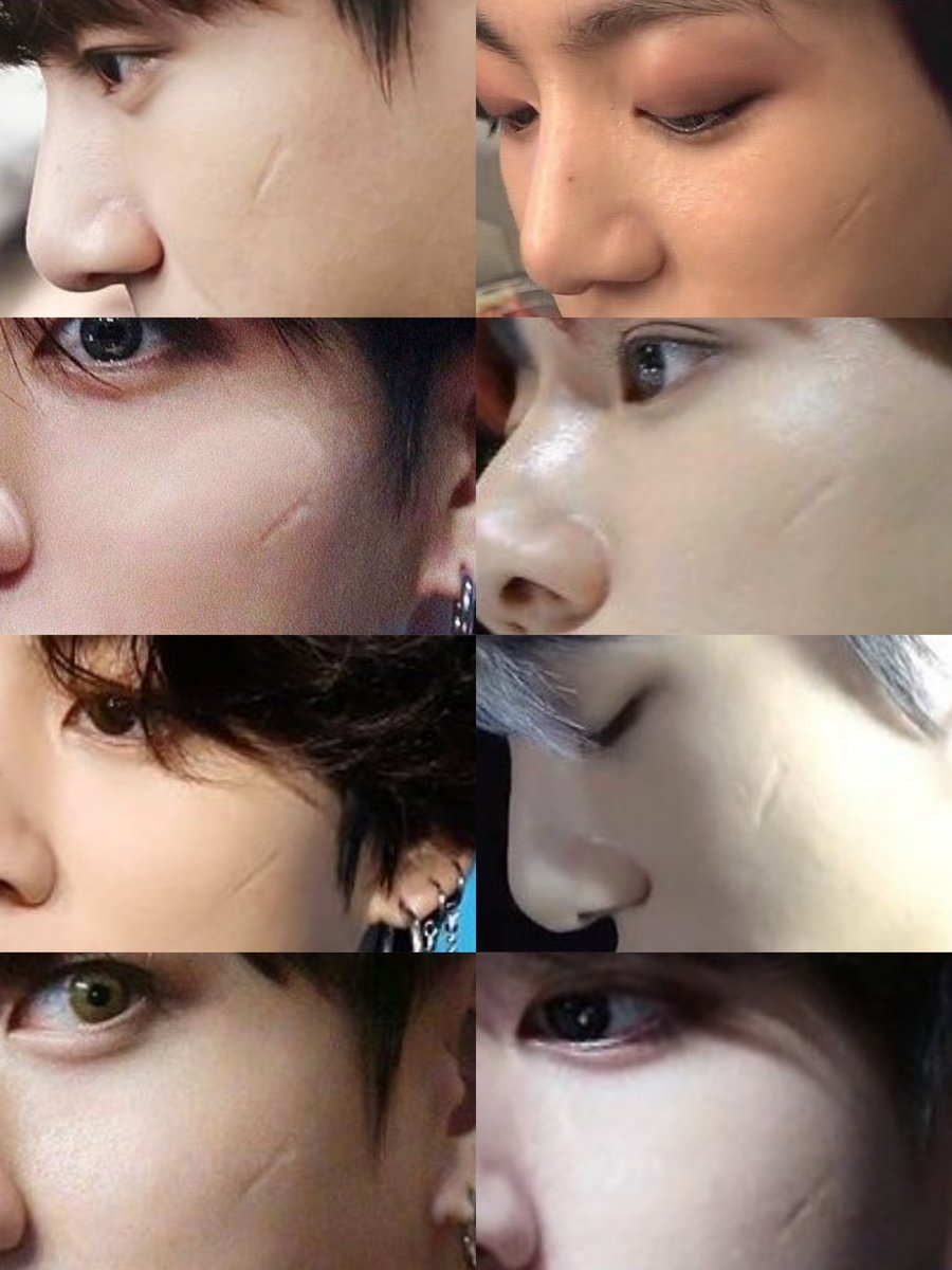 thingskoo's tweet photo. jungkook's pretty scar ♡ https://t.co/8fxchjlO4W