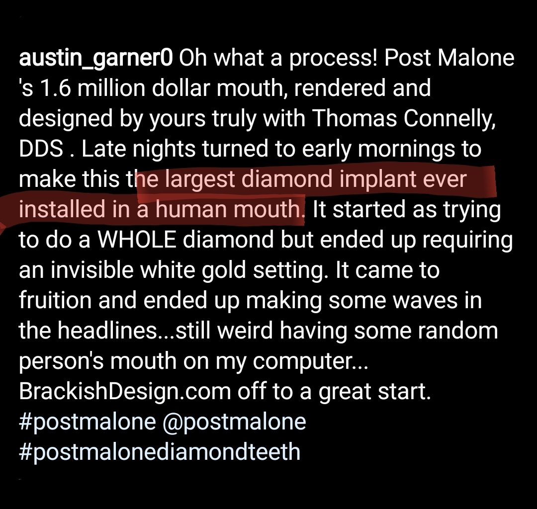 redd_Iverson4's tweet photo. When Post Malone said:
"Bitch I'm smilin, bet you see me from the nosebleeds"
"See the igloo in my mouth when I be grinning, yeah"
He was being deadass ๐
#DiamondTeeth #DiamondRecords #DiamondDaddy #MillionDollarSmile #TwelveCaratToothache #PutYoMoneyWhereYoMoufIs https://t.co/Ea3K8svrwL