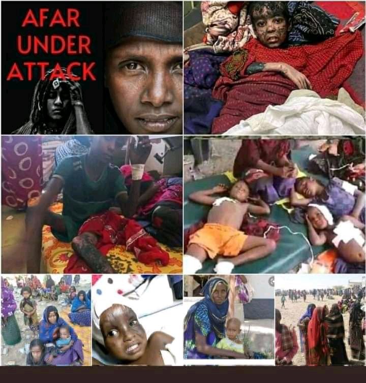 Hussein90353798's tweet photo. @DrTedros How Many people #Afar Die At Home!             
You don't have Any Justice! 
#Afarunderattack 
#StopAfarPeoplegenocide 
 #AfarMassacre https://t.co/vurVvfdGos