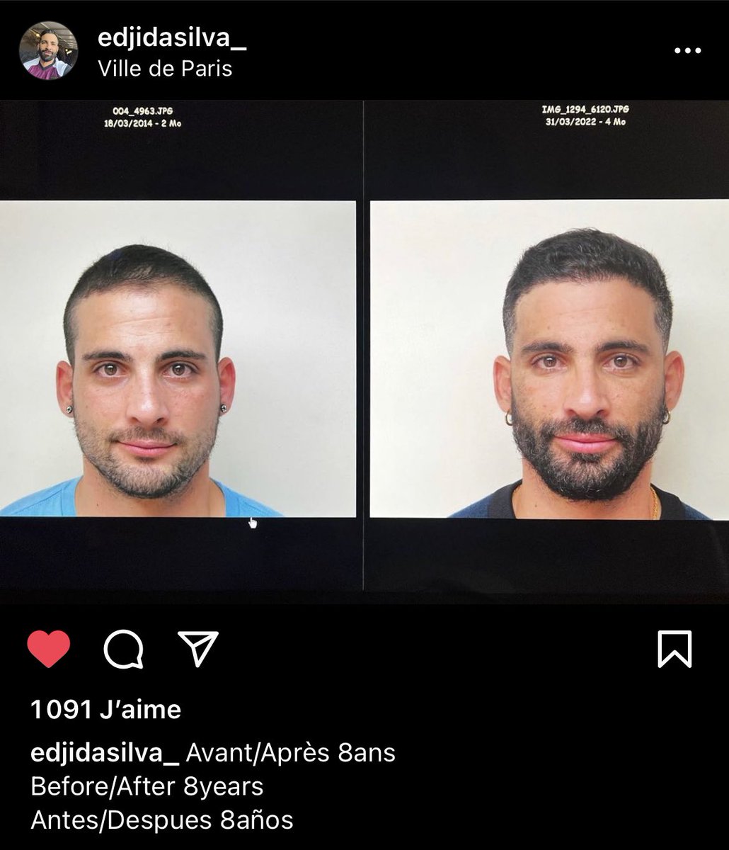 EdjiFan's tweet image. Le temps qui passe lui vas si bien 🥰
❤️@edjidasilvaxx ❤️
#beautiful #time #8year